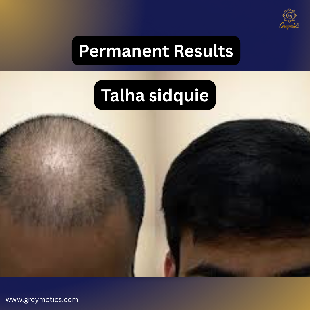 Hairshock Natural Hair Oil, Blend of 13+ Natural Herbs and Cold Press Oils